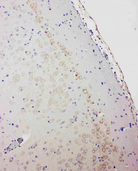 Anti-GABAA Receptor alpha 1