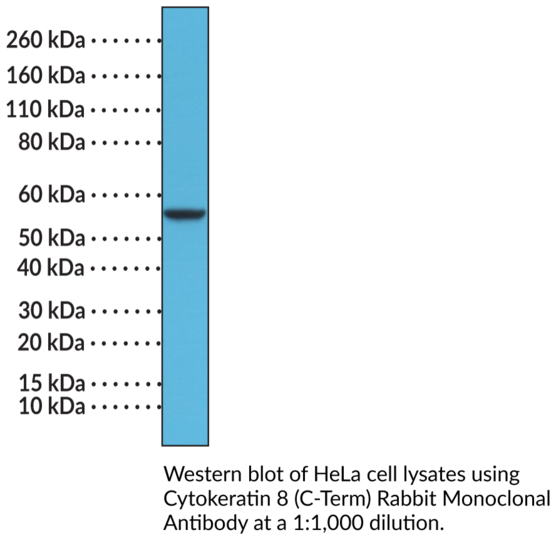 Anti-Cytokeratin 8 (C-Term) Rabbit Monoclonal Antibody (Clone RM266)