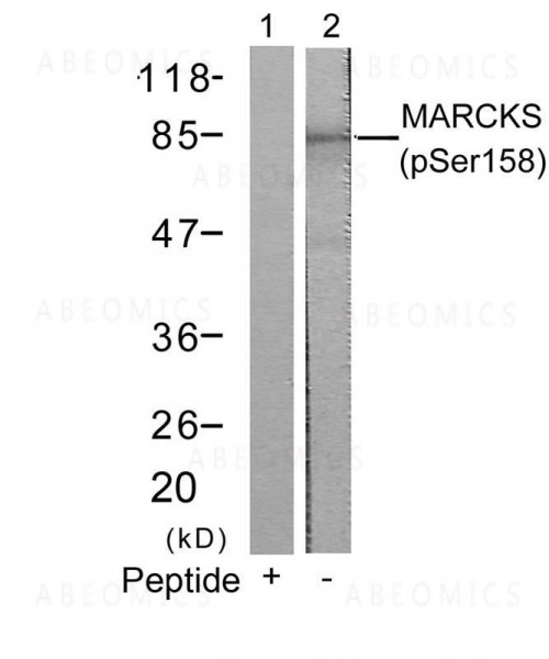 Anti-phospho-MARCKS (Ser158)