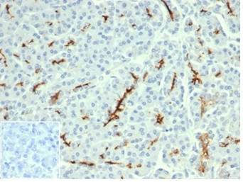 Anti-CFTR (Cystic Fibrosis Transmembrane Conductance Regulator), recombinant antibody, clone CFTR/64