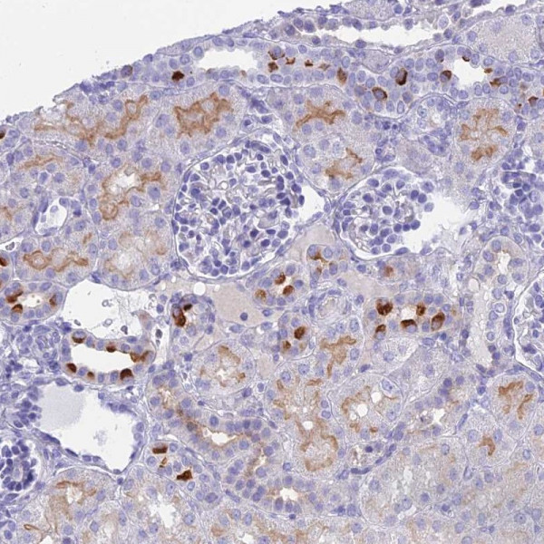 Anti-TMEM161B