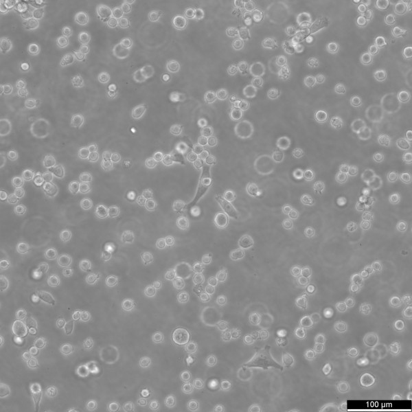 HEL 92.1.7 Cells