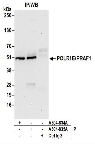 Anti-POLR1E/PRAF1
