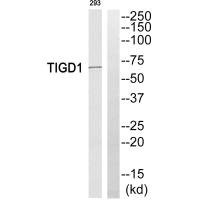 Anti-TIGD1