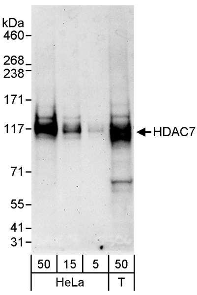 Anti-HDAC7