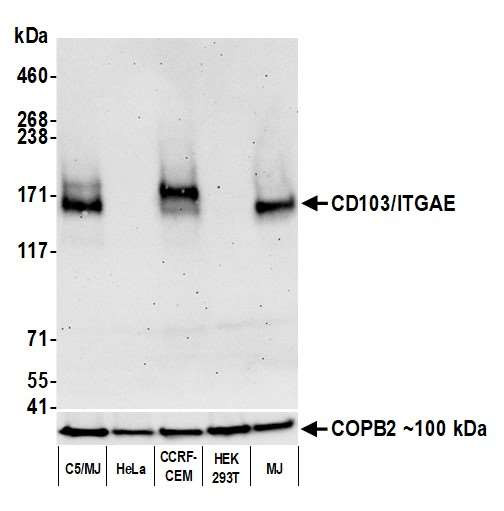 Anti-CD103/ITGAE Recombinant Monoclonal