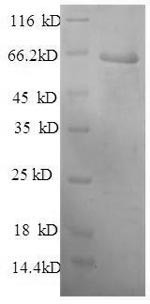 Plasma protease C1 inhibitor (Serping1), partial, mouse, recombinant