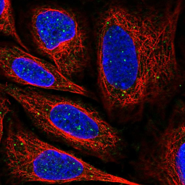 Anti-CLCF1