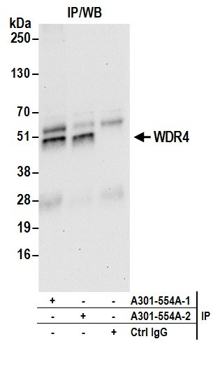 Anti-WDR4