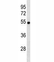 Anti-VANGL2