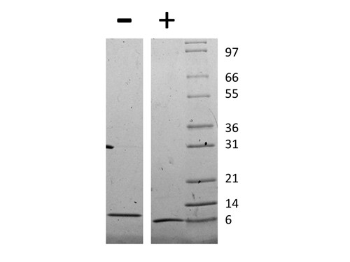 Monocyte Chemotactic Protein-2 (CCL8)