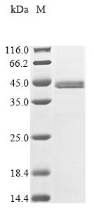Sestrin-3 (SESN3), partial, human, recombinant