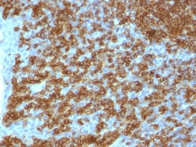 Anti-CD45RA (Leucocyte Marker)(Clone: PTPRC/1148)