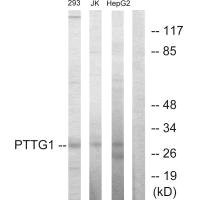 Anti-PTTG1
