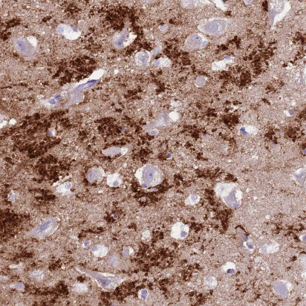 Anti-SLC7A14
