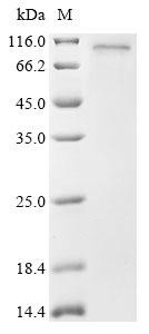 TNFAIP3-interacting protein 1 (TNIP1), human, recombinant