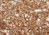 Anti-GOT2 Monoclonal Antibody