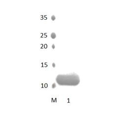STXB4 PDZ Domain