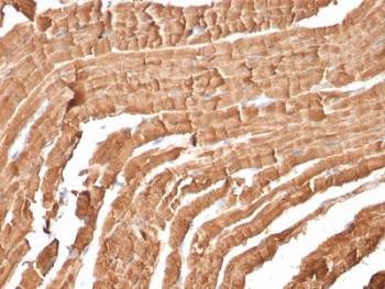 Anti-Myoglobin, clone MB/2105