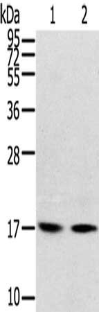 Anti-RPLP1