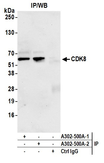 Anti-CDK8