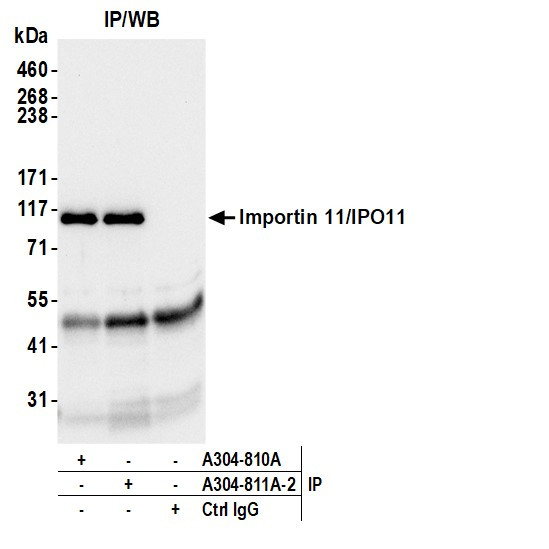 Anti-Importin 11/IPO11