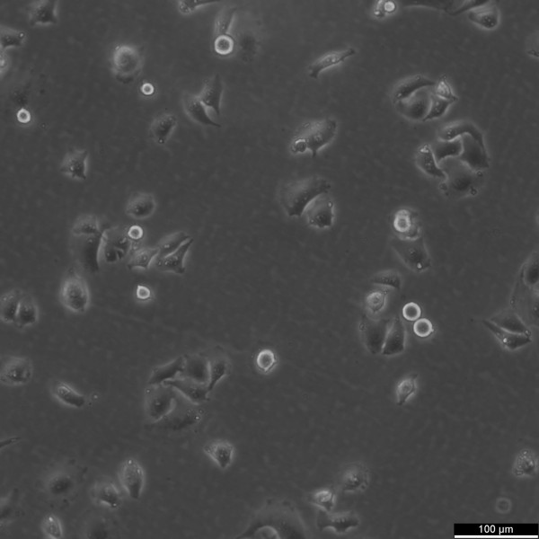KYSE520 Cells