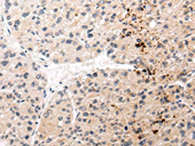 Anti-AQP11