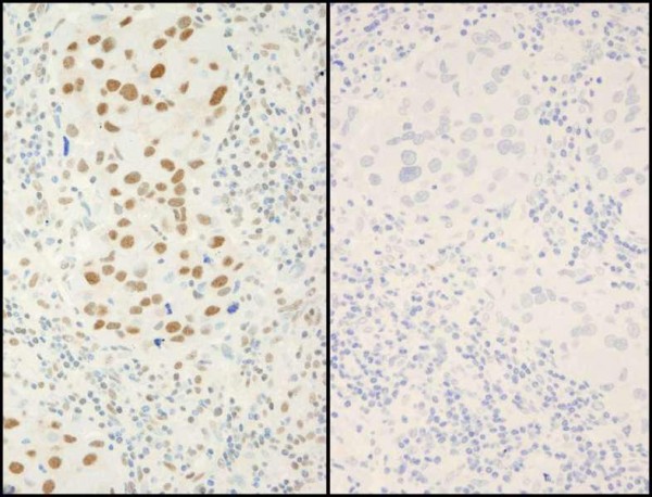 Anti-phospho-XRCC1 (Ser518/Thr519/Thr523) (IHC)