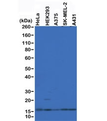 Anti-Histone H2AZ, clone RM215 (recombinant antibody)