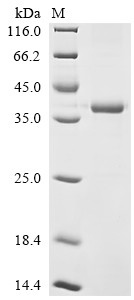 Unconventional myosin-X (MYO10), partial, human, recombinant