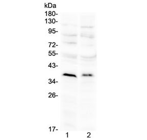 Anti-ATOH1 / MATH1 (N-Terminal Region)