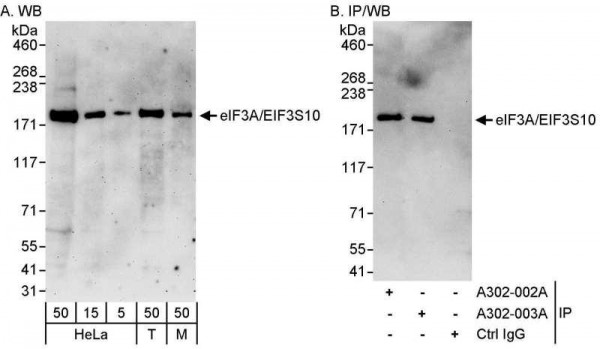 Anti-eIF3A/eIF3S10