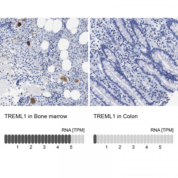 Anti-TREML1
