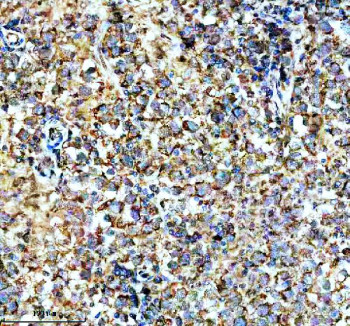 Anti-SPATA6 / Spermatogenesis-associated protein 6