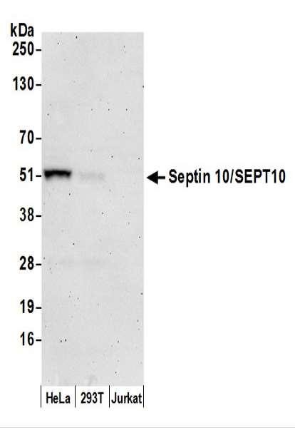 Anti-Septin 10/SEPT10
