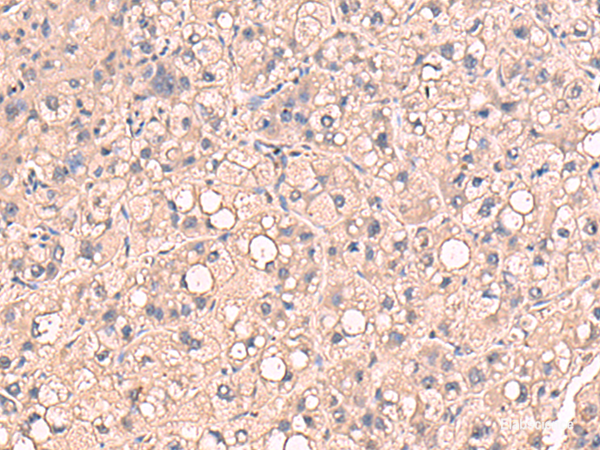 Anti-RIOK1