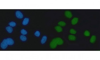 Anti-EXO1 / Exonuclease 1