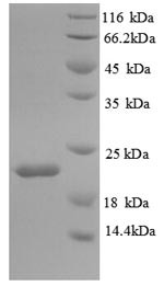 Interleukin-18-binding protein (Il18bp), mouse, recombinant