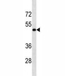 Anti-LOX, clone 624CT23.7.3