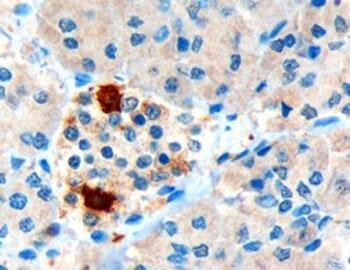 Anti-Pancreatic Polypeptide