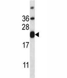 Anti-CD3e