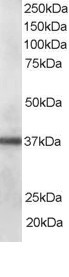 Anti-CLIM1 / PDLIM1, C-terminal