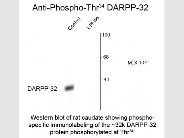 Anti-phospho-DARPP-32 (Thr34)