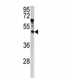 Anti-ANGPTL7