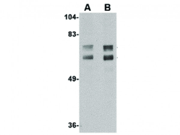 Anti-JPH2
