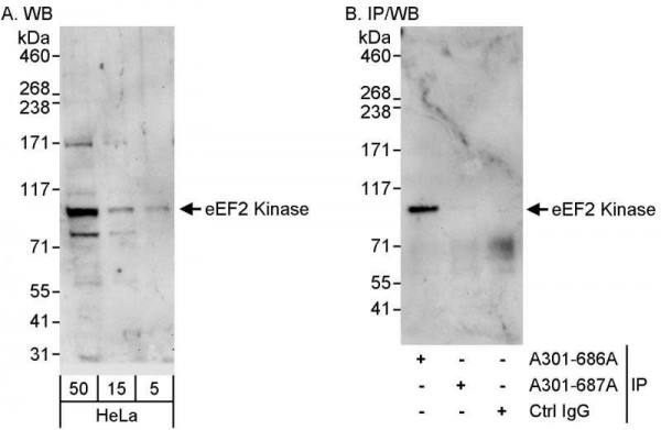 Anti-eEF2 Kinase