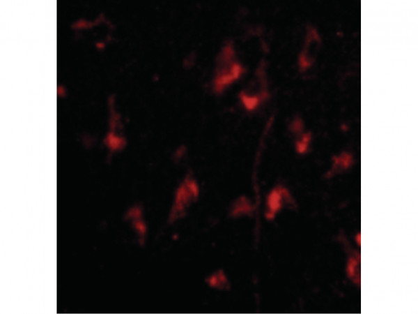Anti-ATG12