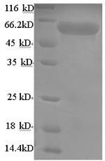 Uncharacterized aarF domain-containing protein kinase 2 (Adck2), partial, mouse, recombinant