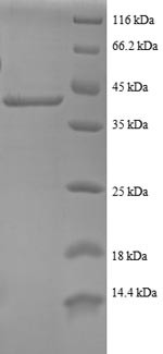 40S ribosomal protein S24 (RPS24), partial, human, recombinant